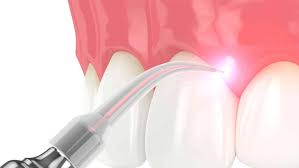 Dental Treatments pic 2